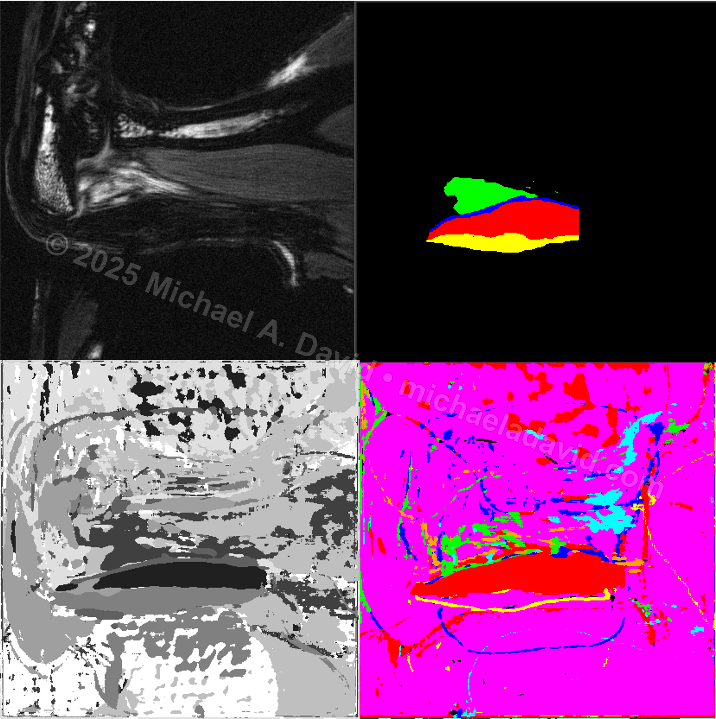 Imaging Machine Learning